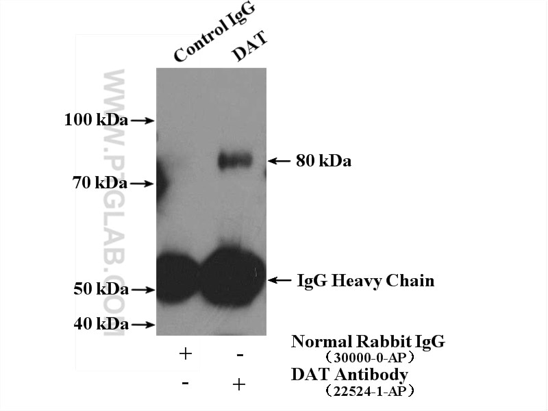 DAT Polyclonal antibody