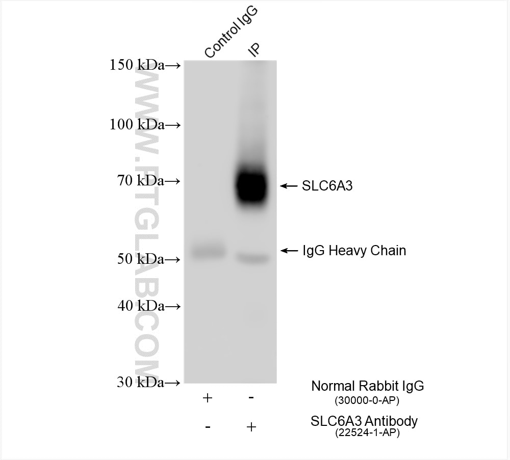 Immunoprecipitation (IP) experiment of mouse brain tissue using Dopamine Transporter/DAT Polyclonal antibody (22524-1-AP)
