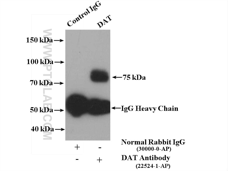 Immunoprecipitation (IP) experiment of mouse brain tissue using DAT Polyclonal antibody (22524-1-AP)