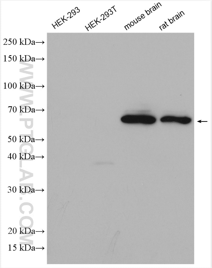 Western Blot (WB) analysis of various lysates using DAT Polyclonal antibody (22524-1-AP)