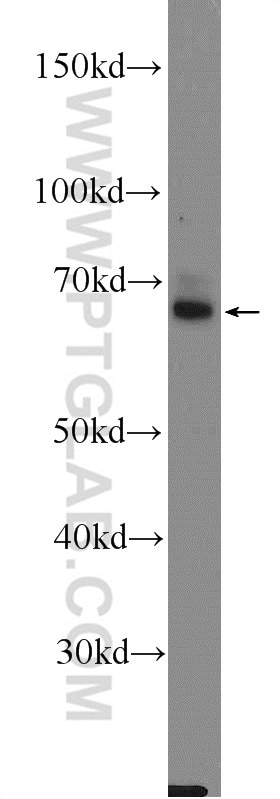 DAT Polyclonal antibody