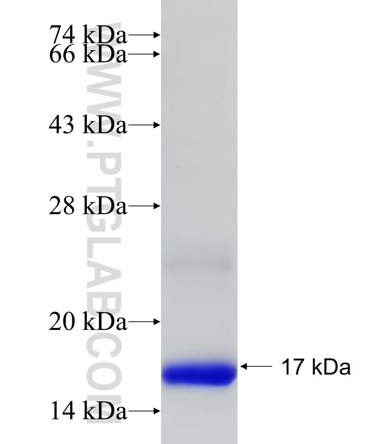 SLC6A3 fusion protein Ag19814 SDS-PAGE