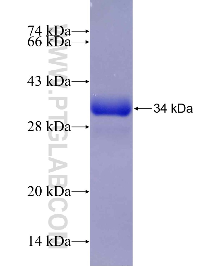 SLC6A3 fusion protein Ag30045 SDS-PAGE