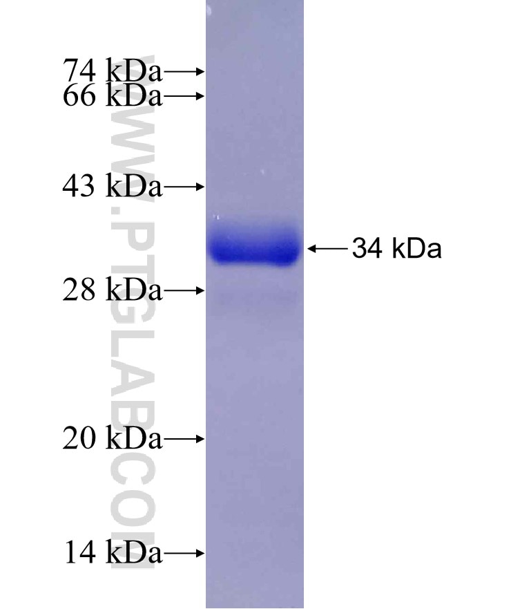 SLC6A3 fusion protein Ag30045 SDS-PAGE