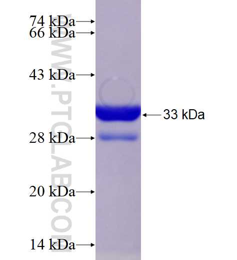SLC6A3 fusion protein Ag18297 SDS-PAGE
