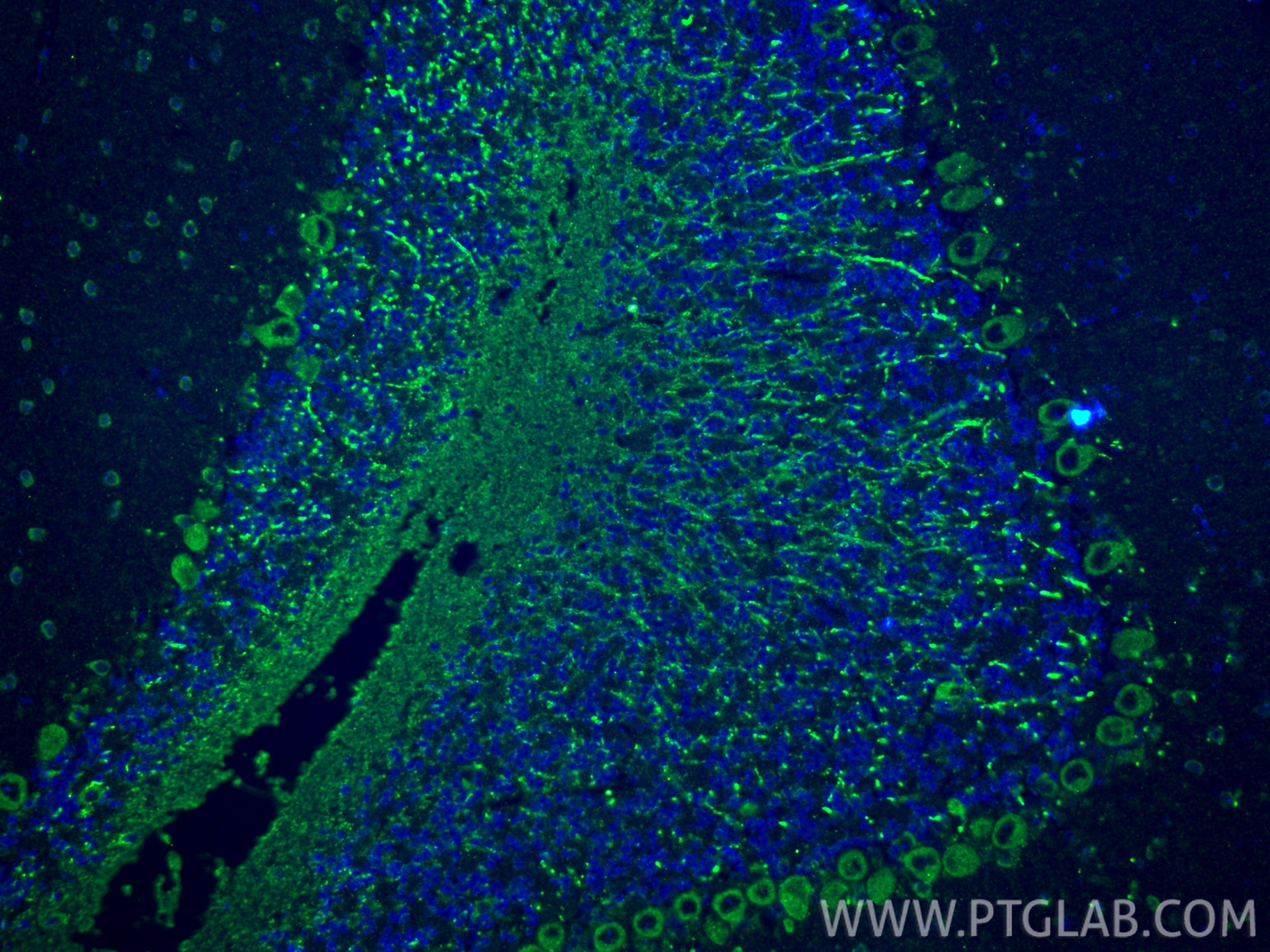 Immunofluorescence (IF) / fluorescent staining of mouse cerebellum tissue using Serotonin transporter Polyclonal antibody (19559-1-AP)