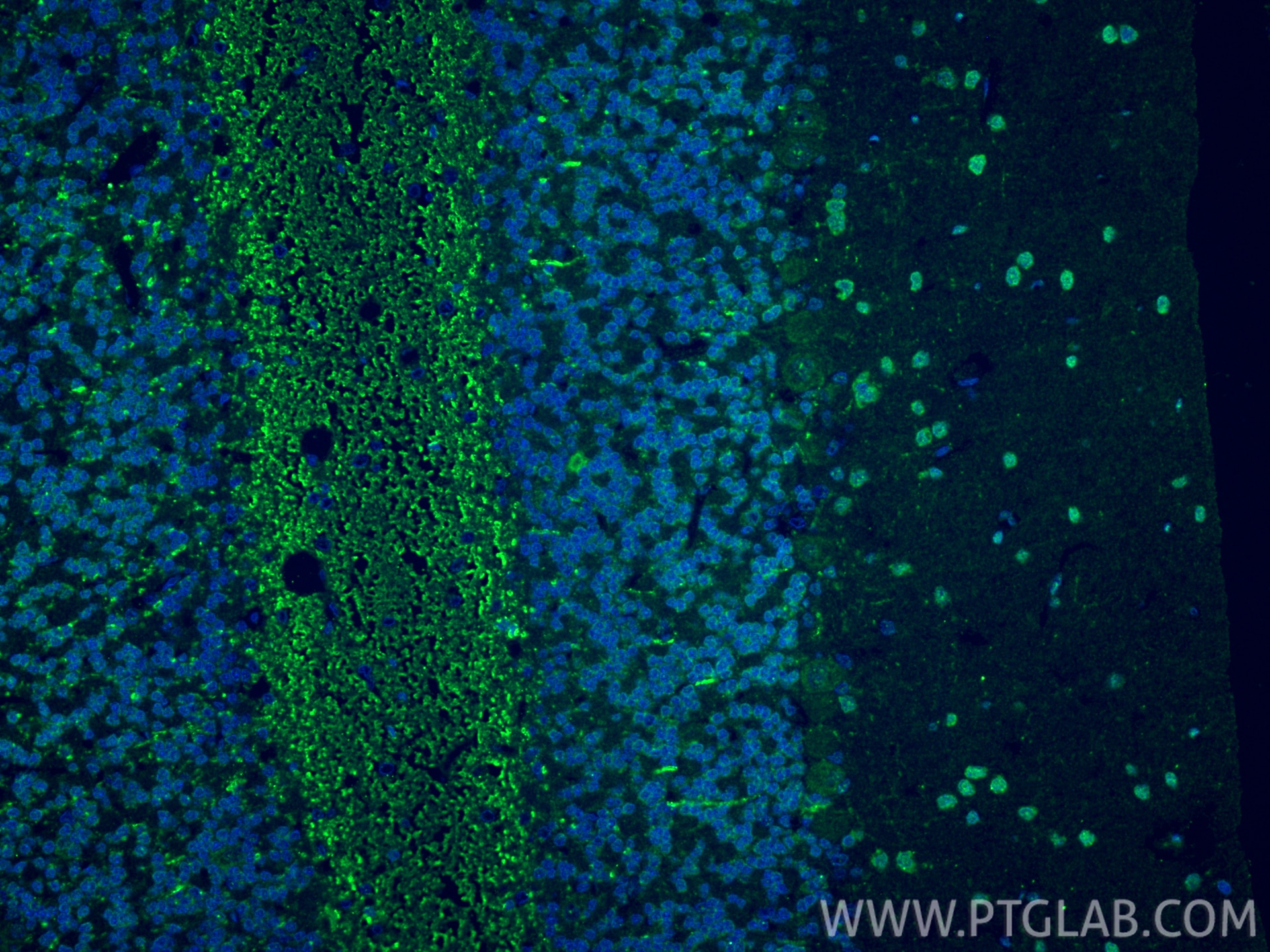 Immunofluorescent analysis of (4% PFA) fixed paraffin-embedded rat cerebellum tissue using Serotonin transporter antibody (19559-1-AP) at dilution of 1:200 and CoraLite®488-Conjugated Goat Anti-Rabbit IgG(H+L) (SA00013-2). Heat mediated antigen retrieval with Tris-EDTA buffer (pH 9.0). Immunofluorescence (IF) / fluorescent staining of rat cerebellum tissue using Serotonin transporter Polyclonal antibody (19559-1-AP)