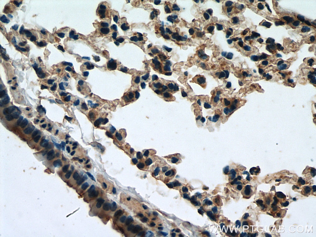 Immunohistochemistry (IHC) staining of mouse lung tissue using Serotonin transporter Polyclonal antibody (19559-1-AP)