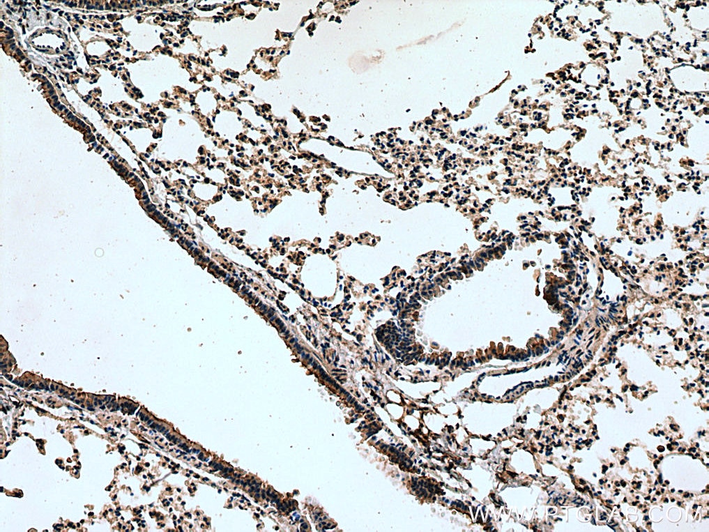 Immunohistochemistry (IHC) staining of mouse lung tissue using Serotonin transporter Polyclonal antibody (19559-1-AP)