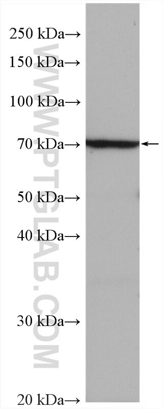 Western Blot (WB) analysis of various lysates using Serotonin transporter Polyclonal antibody (19559-1-AP)