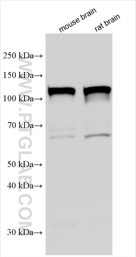 Western Blot (WB) analysis of various lysates using Serotonin transporter Polyclonal antibody (19559-1-AP)