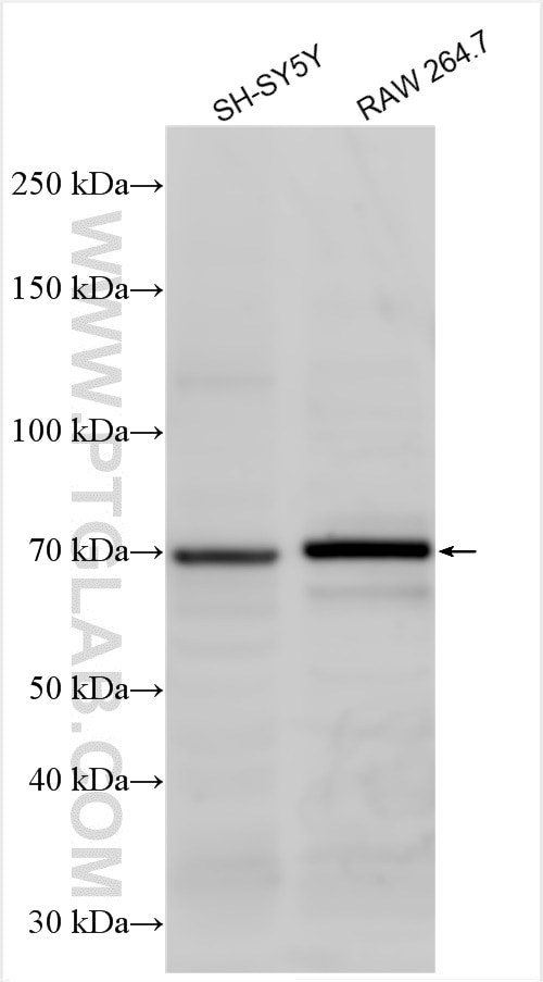 Western Blot (WB) analysis of various lysates using Serotonin transporter Polyclonal antibody (29186-1-AP)