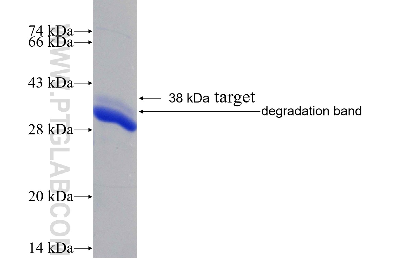 SLC6A4 fusion protein Ag30412 SDS-PAGE