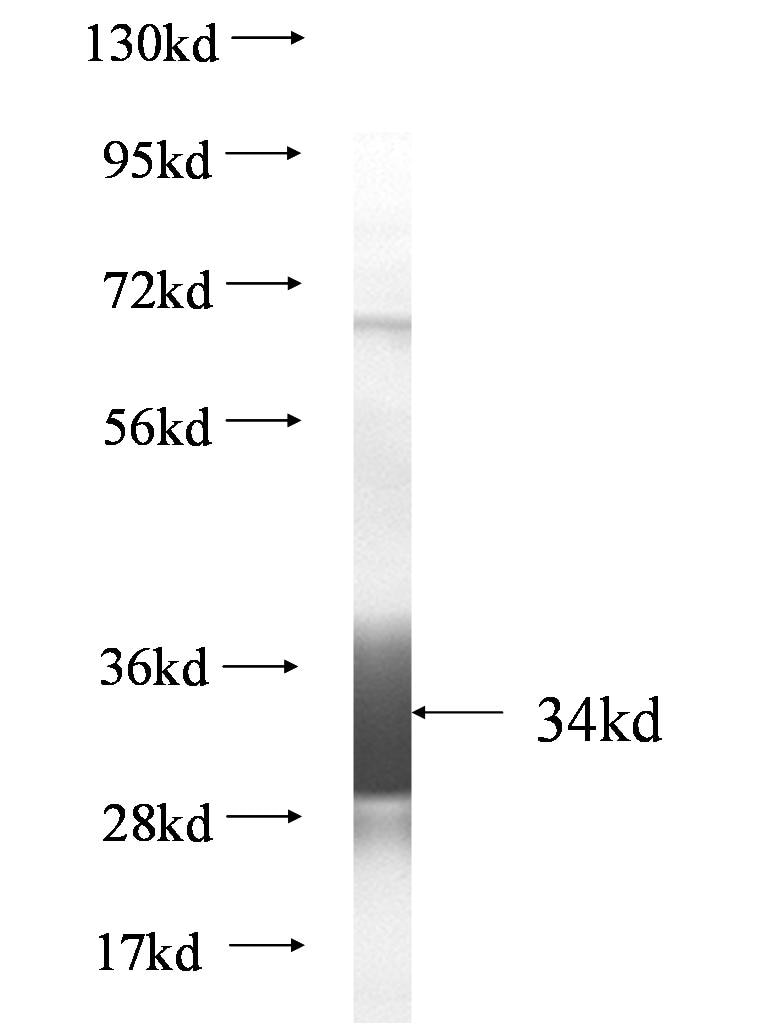 SLC6A4 fusion protein Ag0817 SDS-PAGE