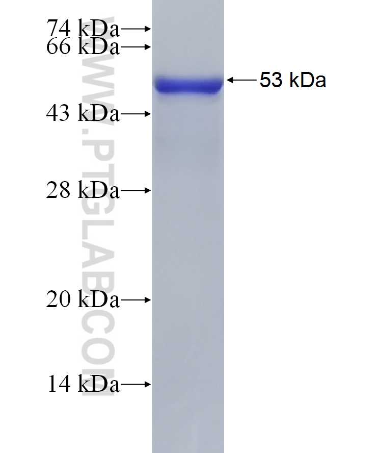 SLC6A5 fusion protein Ag22835 SDS-PAGE