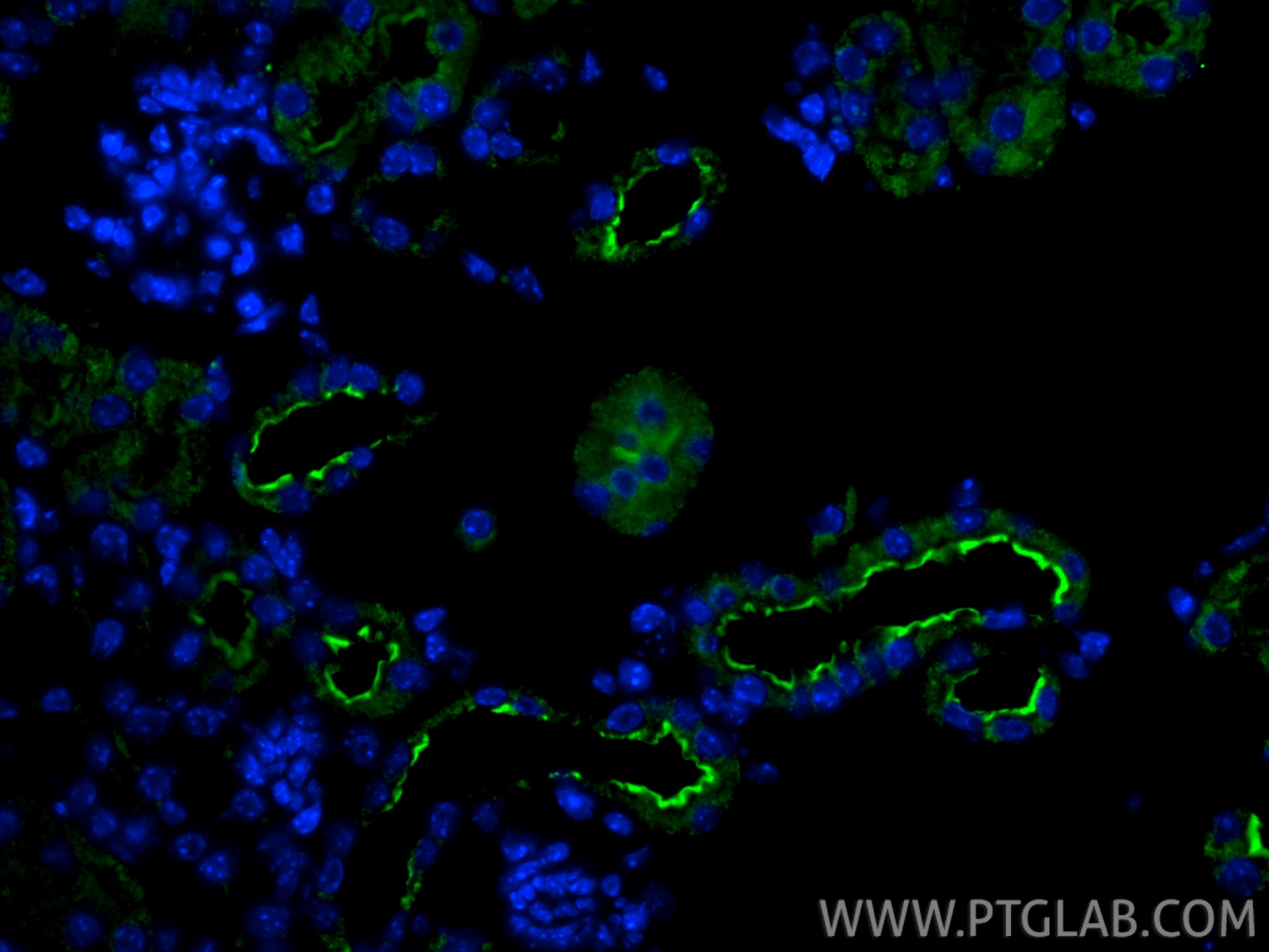 Immunofluorescence (IF) / fluorescent staining of mouse kidney tissue using SLC6A6/TAUT Polyclonal antibody (26725-1-AP)