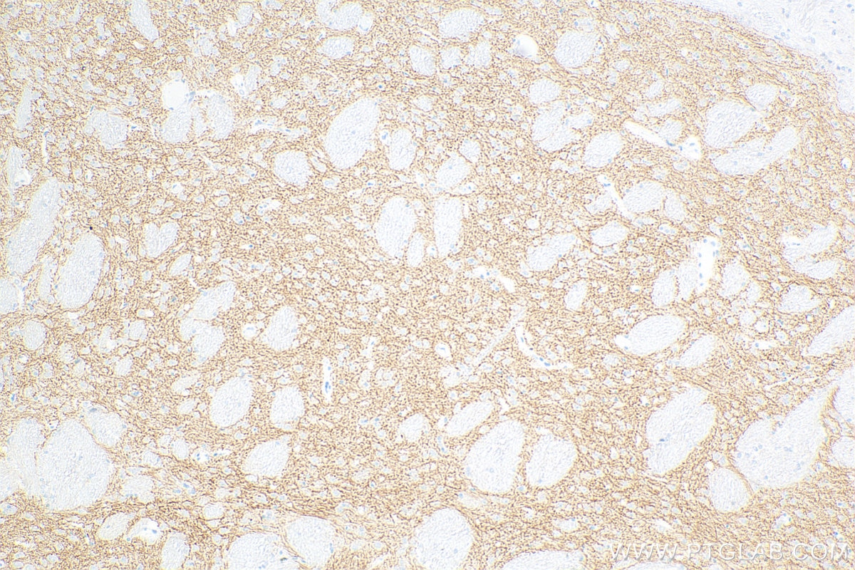 Immunohistochemistry (IHC) staining of rat brain tissue using SLC6A7 Recombinant antibody (83412-4-RR)