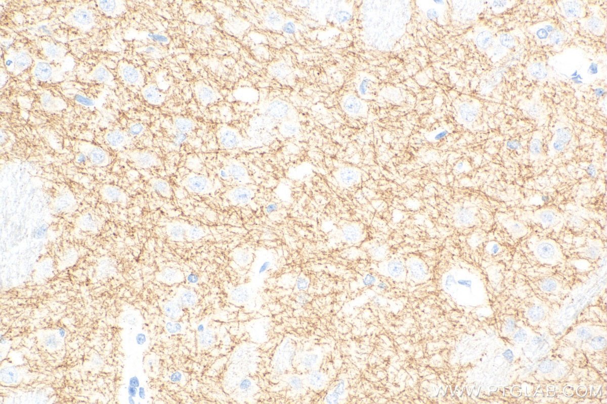 Immunohistochemistry (IHC) staining of rat brain tissue using SLC6A7 Recombinant antibody (83412-4-RR)