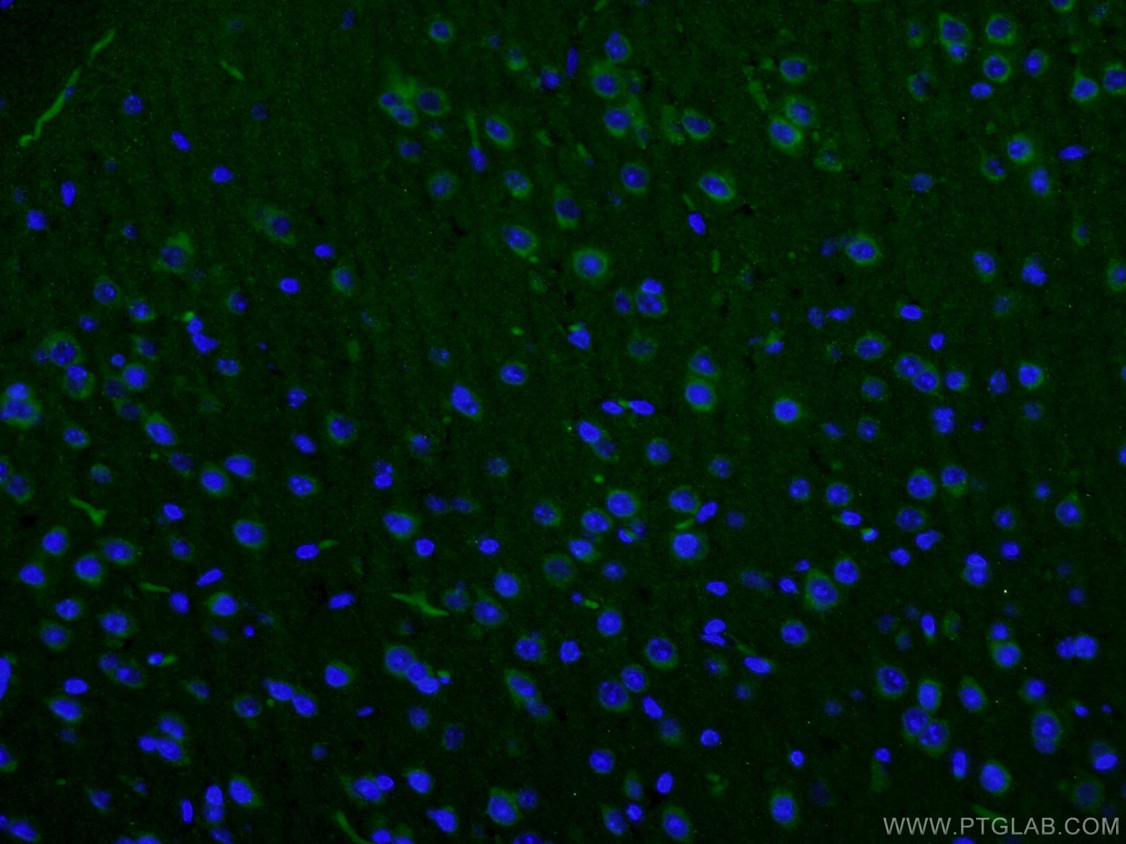 Immunofluorescence (IF) / fluorescent staining of mouse brain tissue using SLC6A8 Polyclonal antibody (20299-1-AP)