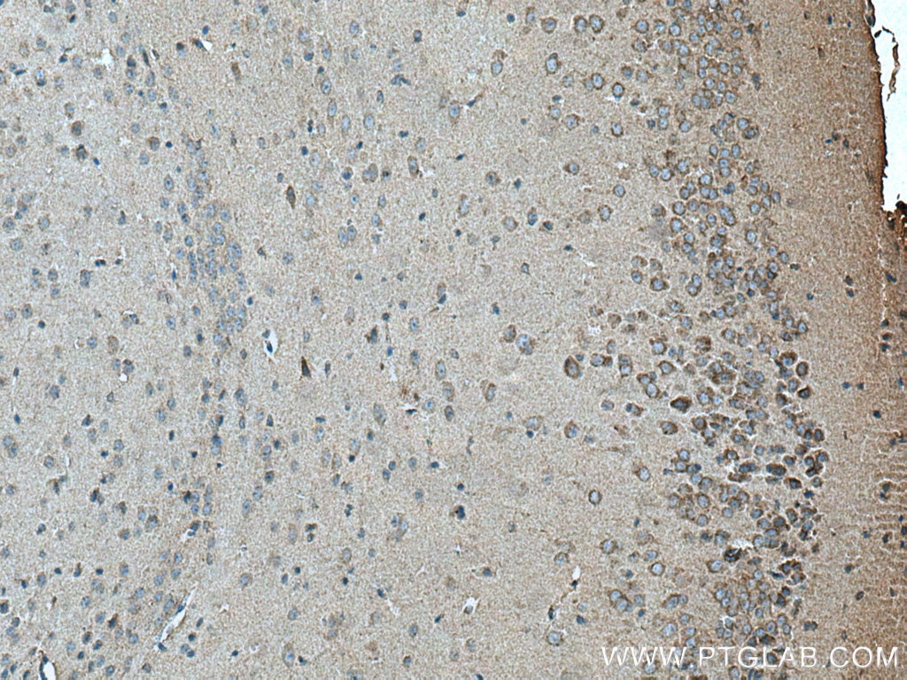 IHC staining of mouse brain using 20299-1-AP