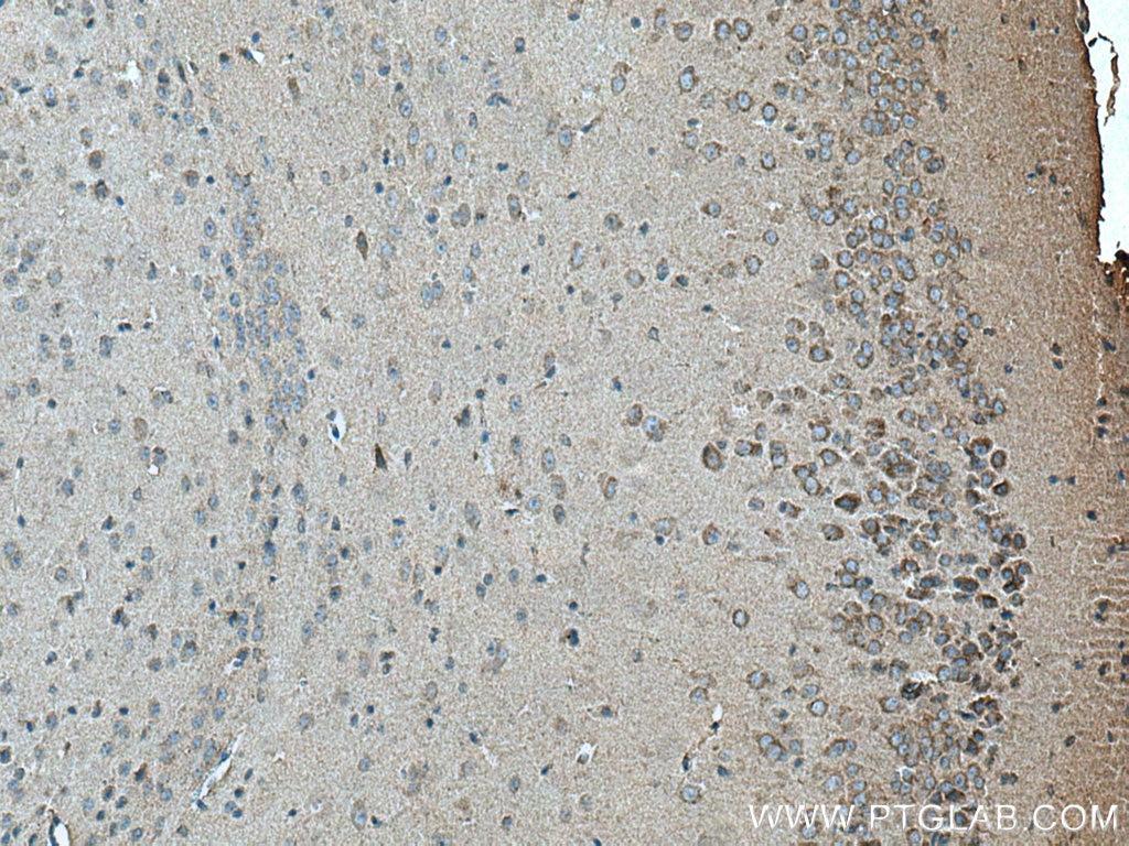 Immunohistochemistry (IHC) staining of mouse brain tissue using SLC6A8 Polyclonal antibody (20299-1-AP)