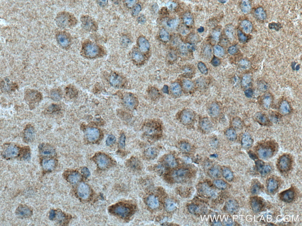 Immunohistochemistry (IHC) staining of mouse brain tissue using SLC6A8 Polyclonal antibody (20299-1-AP)