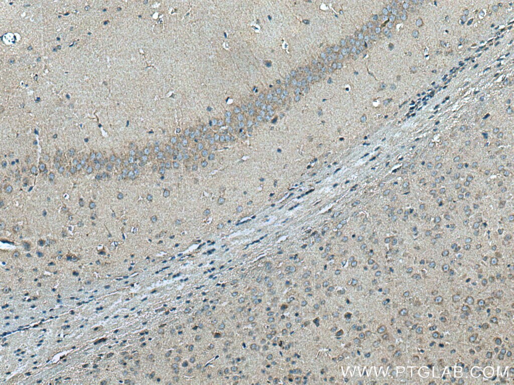 Immunohistochemistry (IHC) staining of mouse brain tissue using SLC6A8 Polyclonal antibody (20299-1-AP)