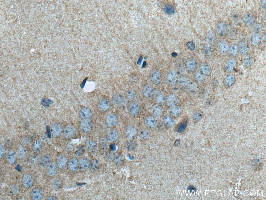 Immunohistochemistry (IHC) staining of mouse brain tissue using SLC6A8 Polyclonal antibody (20299-1-AP)