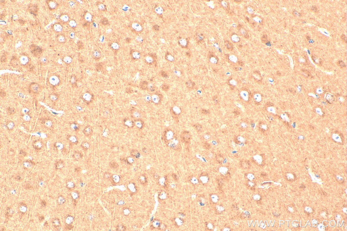 Immunohistochemistry (IHC) staining of mouse brain tissue using SLC6A8 Polyclonal antibody (20299-1-AP)