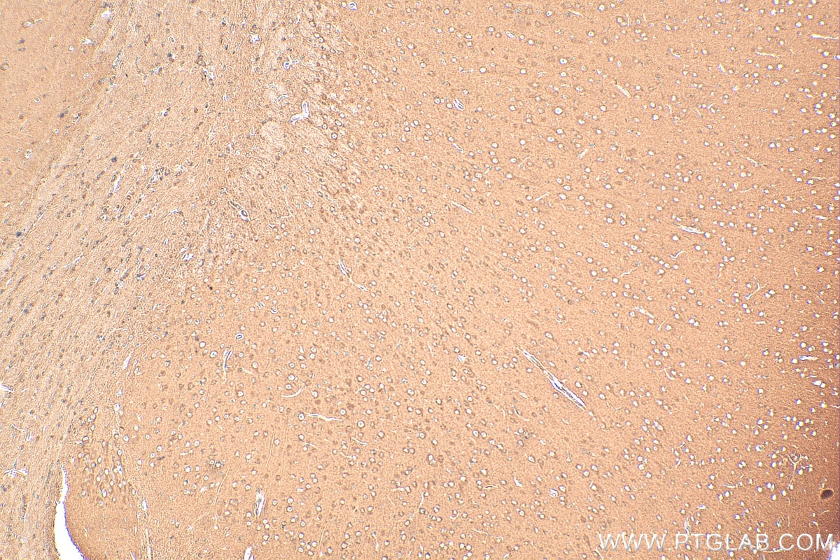 Immunohistochemistry (IHC) staining of mouse brain tissue using SLC6A8 Polyclonal antibody (20299-1-AP)