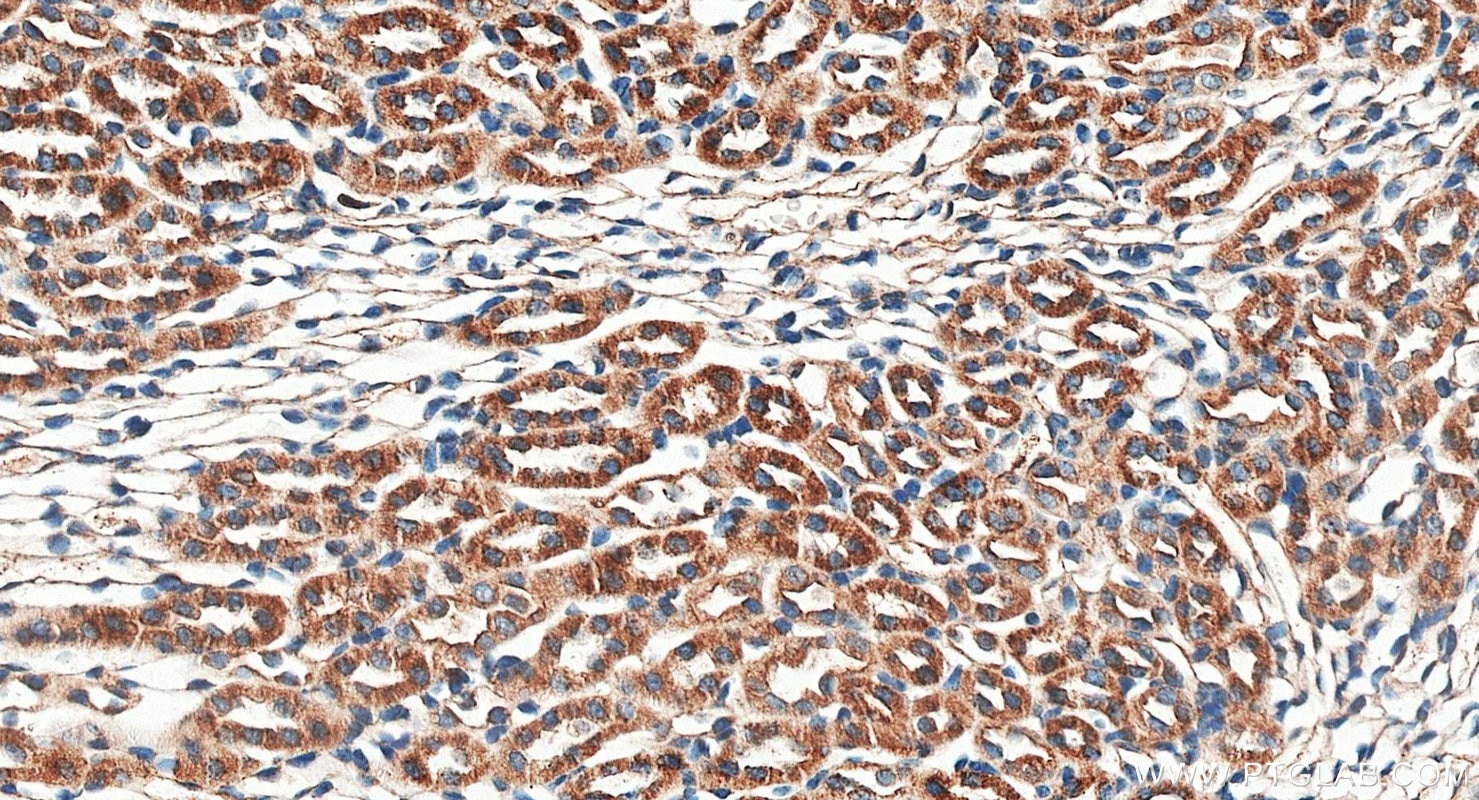 Immunohistochemistry (IHC) staining of mouse kidney tissue using SLC6A8 Polyclonal antibody (20299-1-AP)