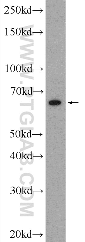 Western Blot (WB) analysis of HUVEC cells using SLC6A8 Polyclonal antibody (20299-1-AP)