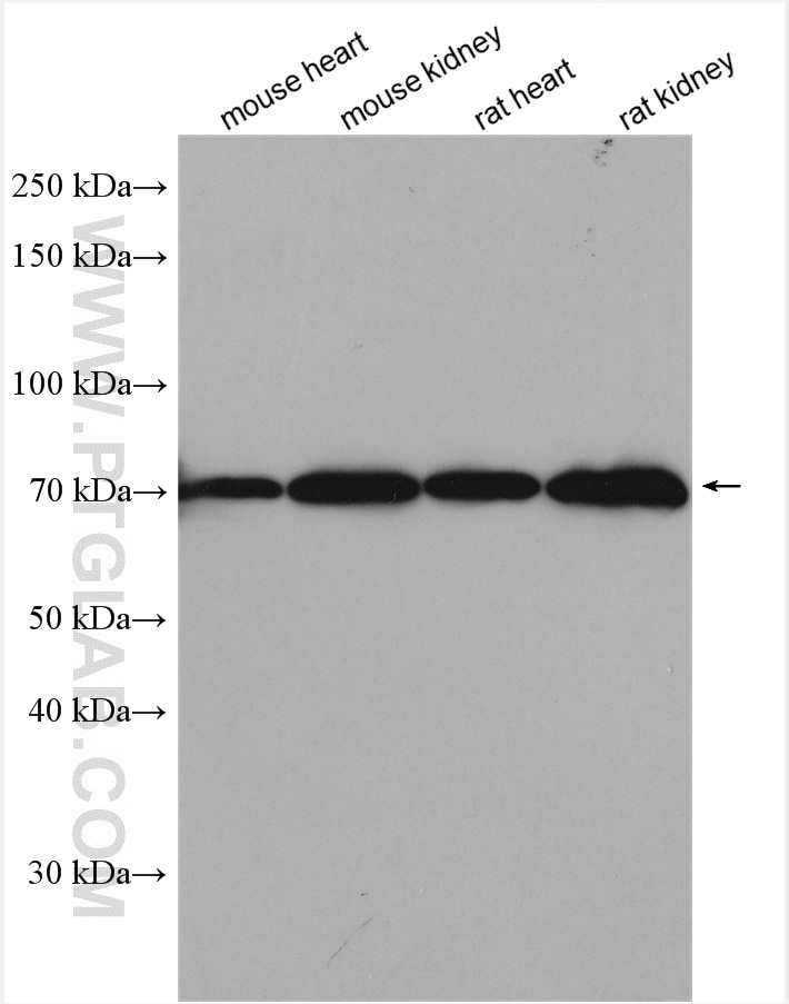 Western Blot (WB) analysis of various lysates using SLC6A8 Polyclonal antibody (20299-1-AP)