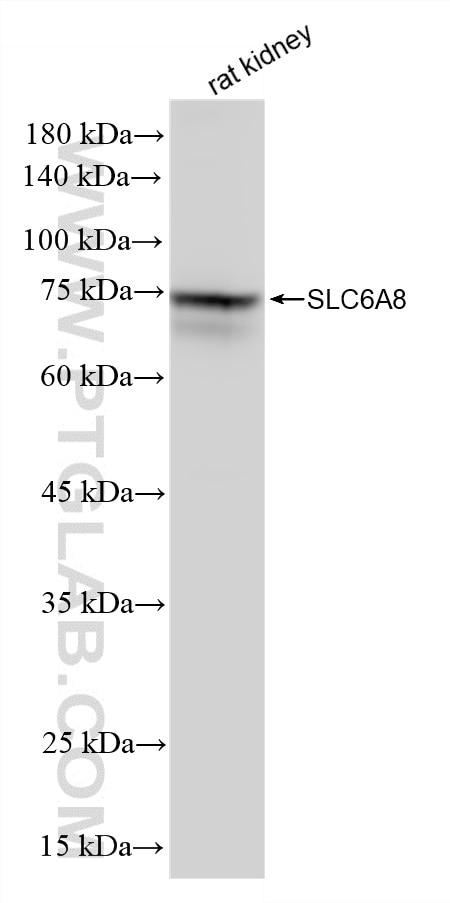 WB analysis of rat kidney using 88049-1-RR Western Blot (WB) analysis of rat kidney tissue using SLC6A8 Recombinant monoclonal antibody (88049-1-RR)