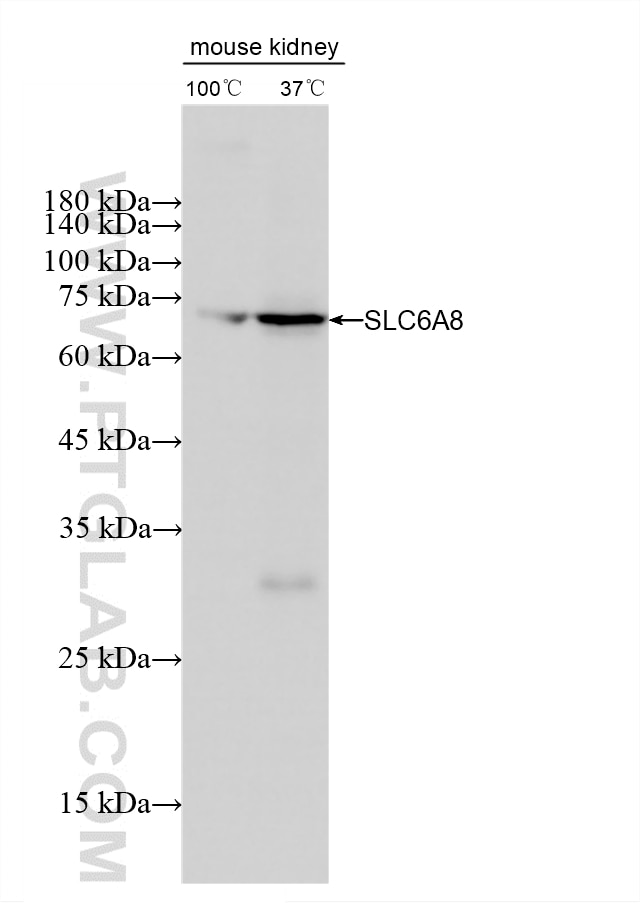 WB analysis using 88049-1-RR Western Blot (WB) analysis of various lysates using SLC6A8 Recombinant monoclonal antibody (88049-1-RR)