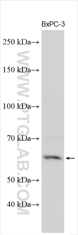 Western Blot (WB) analysis of various lysates using SLC6A9 / GlyT1 Polyclonal antibody (30971-1-AP)