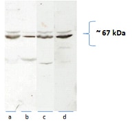 Western Blot (WB) analysis of rat brain/liver tissue using CAT-1 Polyclonal antibody (14195-1-AP)