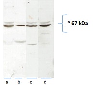 WB analysis of rat brain/liver tissue using 14195-1-AP