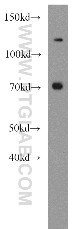 Western Blot (WB) analysis of Jurkat cells using CAT-1 Polyclonal antibody (14195-1-AP)