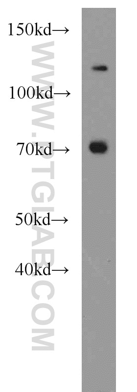 WB analysis of Jurkat using 14195-1-AP