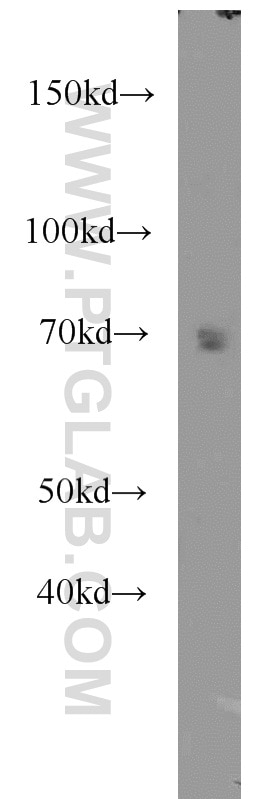Western Blot (WB) analysis of HepG2 cells using CAT-1 Polyclonal antibody (14195-1-AP)