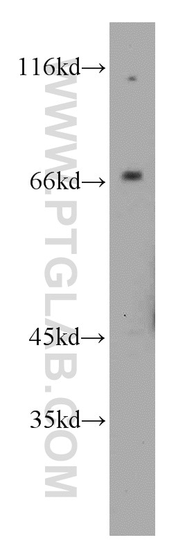 Western Blot (WB) analysis of mouse liver tissue using CAT-1 Polyclonal antibody (14195-1-AP)