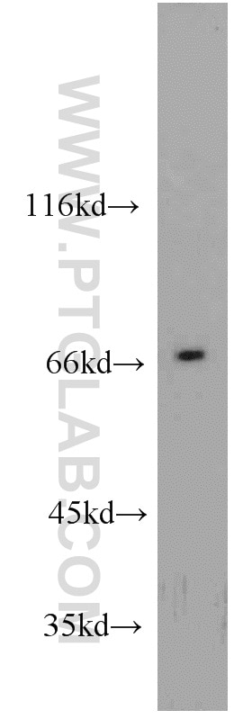 Western Blot (WB) analysis of mouse heart tissue using CAT-1 Polyclonal antibody (14195-1-AP)