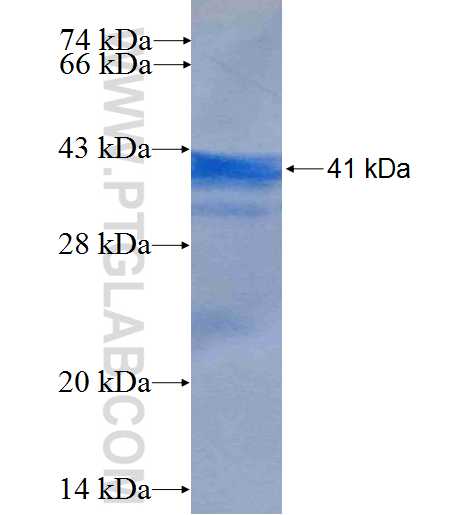 SLC7A1 fusion protein Ag5398 SDS-PAGE
