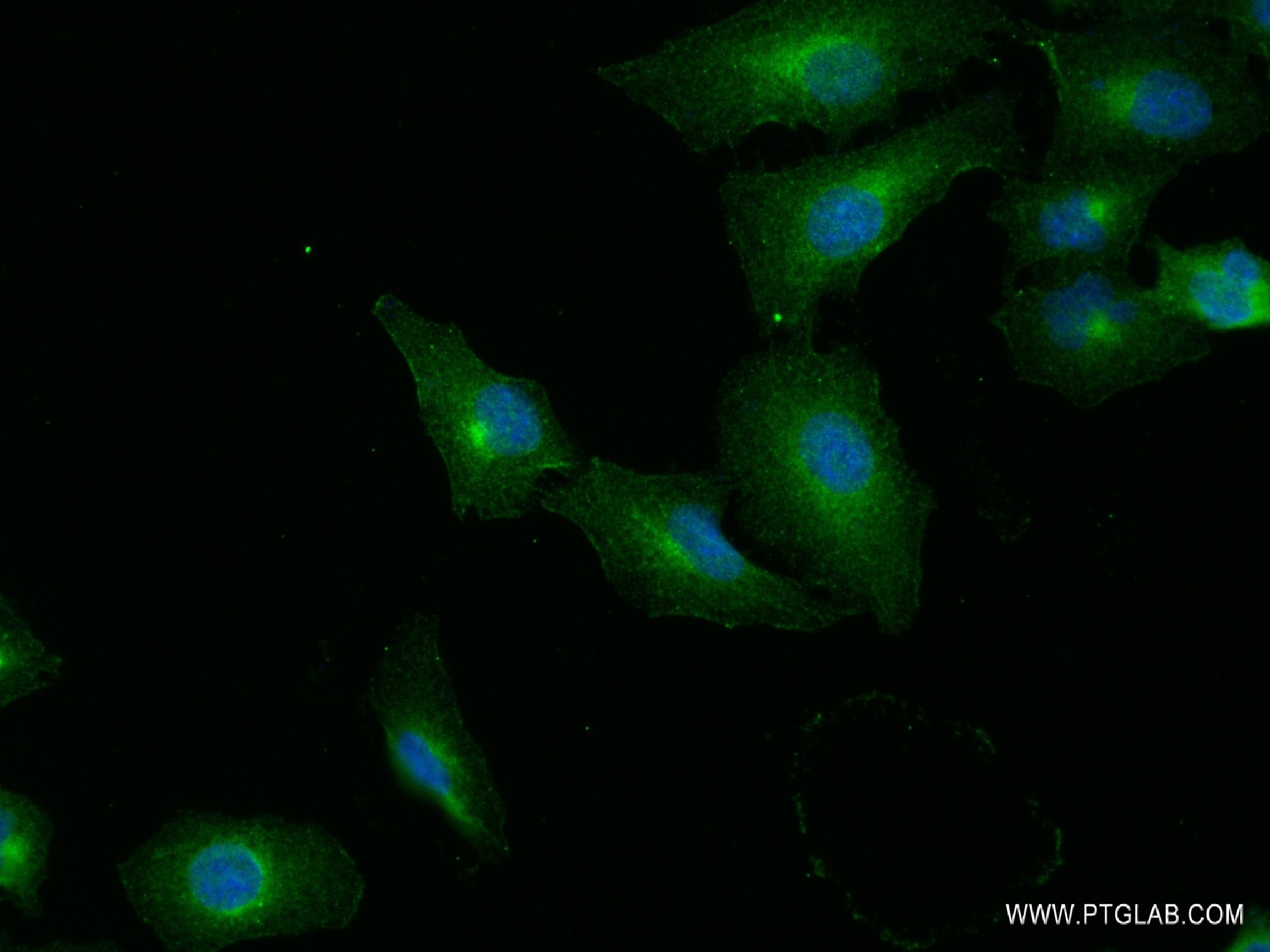 Immunofluorescence (IF) / fluorescent staining of A549 cells using SLC7A11/xCT Recombinant antibody (82115-2-RR)