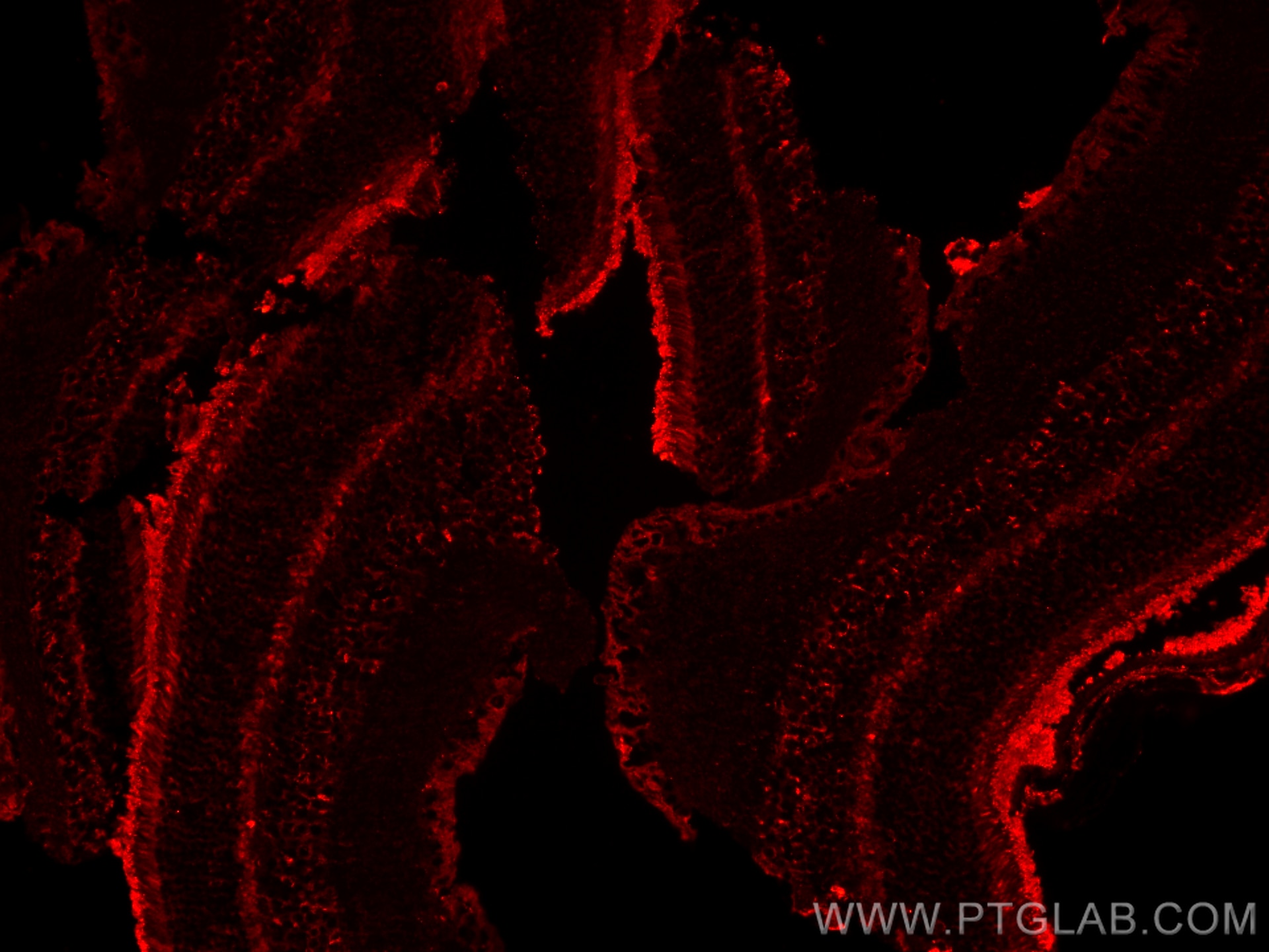 Immunofluorescence (IF) / fluorescent staining of mouse eye tissue using SLC7A11/xCT Polyclonal antibody (32384-1-AP)