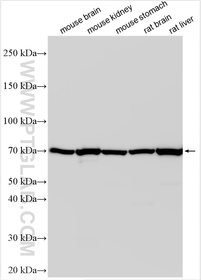 Western Blot (WB) analysis of various lysates using SLC7A11/xCT Polyclonal antibody (32384-1-AP)