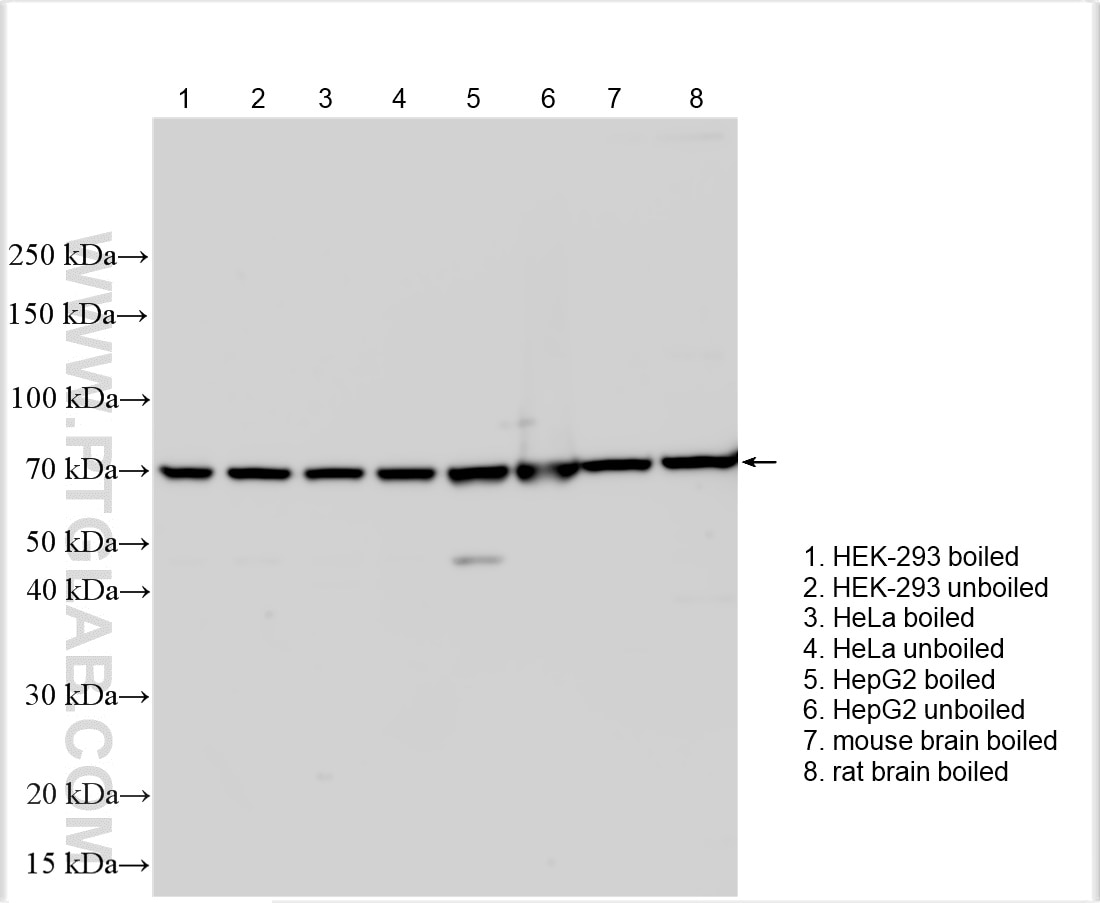 Western Blot (WB) analysis of various lysates using SLC7A11/xCT Polyclonal antibody (32384-1-AP)