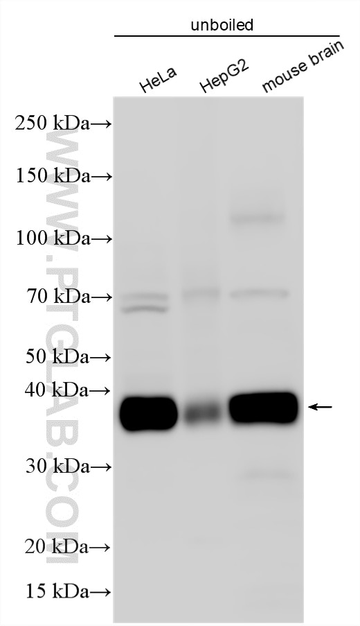 Western Blot (WB) analysis of various lysates using SLC7A11/xCT Polyclonal antibody (32384-1-AP)