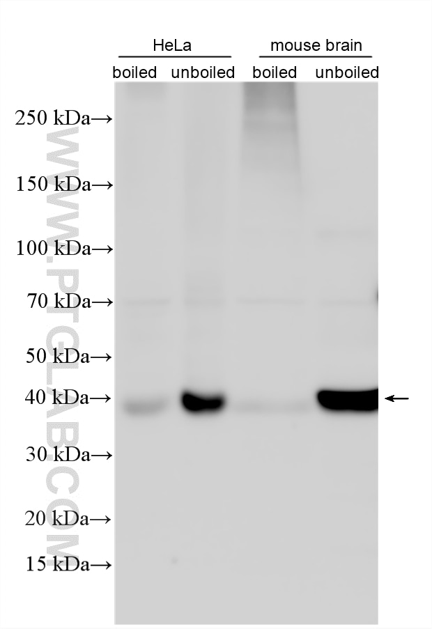 Western Blot (WB) analysis of various lysates using SLC7A11/xCT Polyclonal antibody (32384-1-AP)